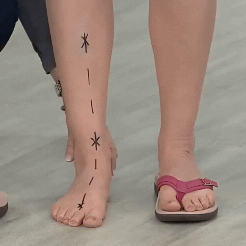 Denzeno's Orthopädische Sommersandalen (50% Rabatt)