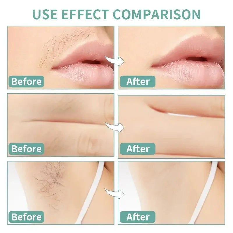 Denzeno Facial Wax Strips – Quick &amp; Painless Hair Removal Kit