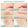 Denzeno Facial Wax Strips – Quick & Painless Hair Removal Kit
